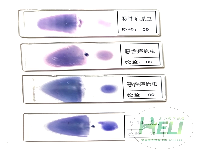 寄生蟲類玻片-惡性瘧原蟲涂片